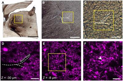 Block Face Scanning Electron Microscopy of Fluorescently Labeled Axons Without Using Near Infra-Red Branding